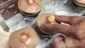 pimple-cupcake (1)